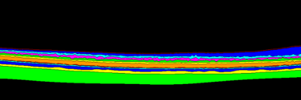 Retinal Image