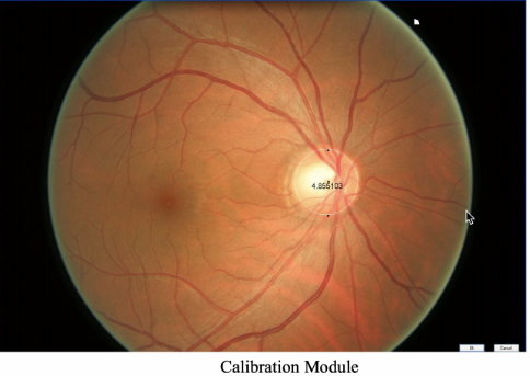 Retinal Image