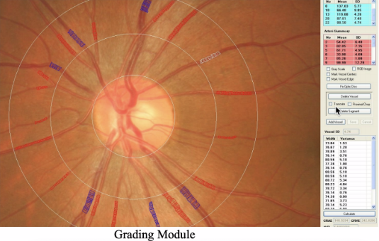 Retinal Image