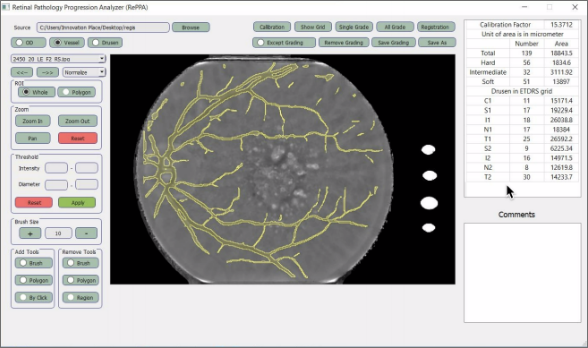 Retinal Image