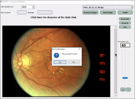 Retinal Image